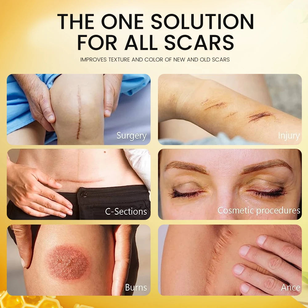 Crema para eliminar cicatrices Sumifun